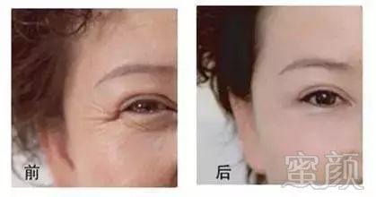 https://img.miyanlife.com/mnt/timg/180117/123A01057-10.jpg