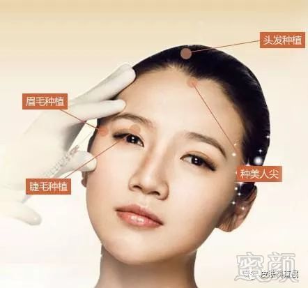 https://img.miyanlife.com/mnt/timg/180117/1256341449-1.jpg