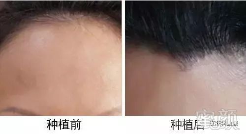 https://img.miyanlife.com/mnt/timg/180117/1256343436-6.jpg