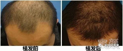 https://img.miyanlife.com/mnt/timg/180117/1256344224-2.jpg