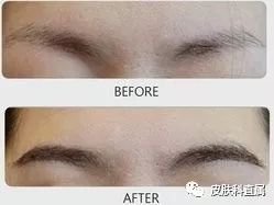 https://img.miyanlife.com/mnt/timg/180117/1256345U8-4.jpg