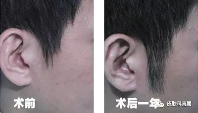https://img.miyanlife.com/mnt/timg/180117/125634C53-5.jpg