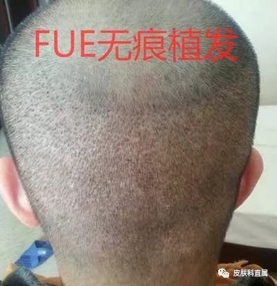 https://img.miyanlife.com/mnt/timg/180117/125635O94-7.jpg