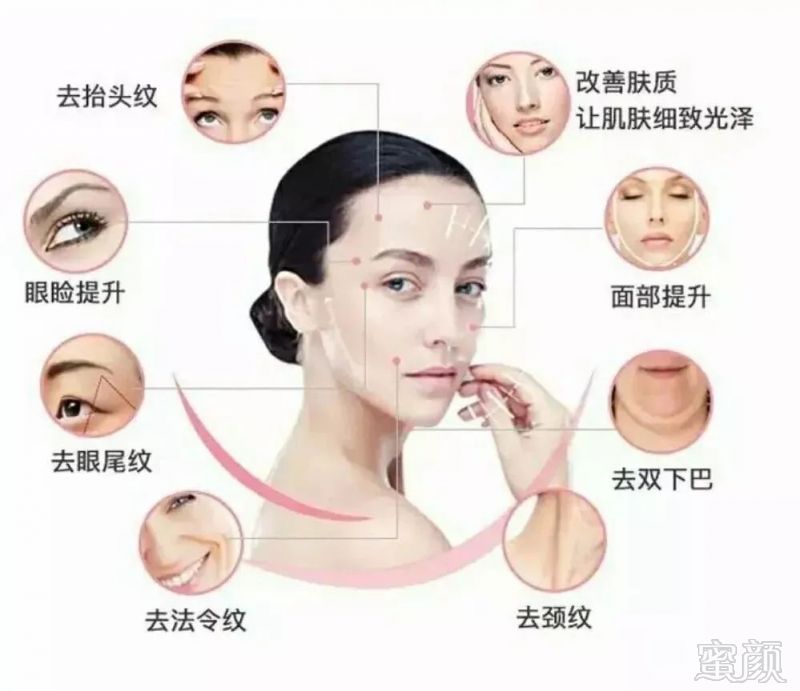 https://img.miyanlife.com/mnt/timg/180118/1145105Q8-1.jpg
