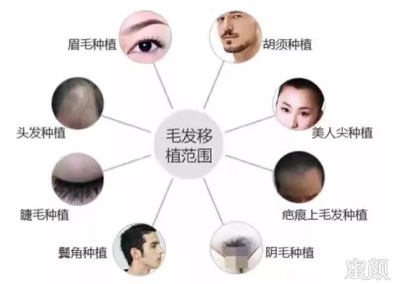https://img.miyanlife.com/mnt/timg/180118/1226331K8-3.jpg