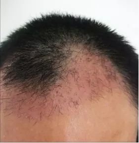 https://img.miyanlife.com/mnt/timg/180118/124K25L8-2.jpg