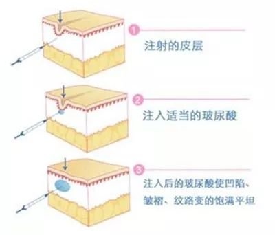 案例图片