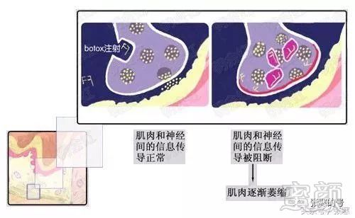 案例图片