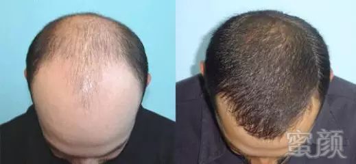 https://img.miyanlife.com/mnt/timg/180118/132G53B0-2.jpg