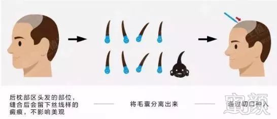 https://img.miyanlife.com/mnt/timg/180118/13311RB6-1.jpg