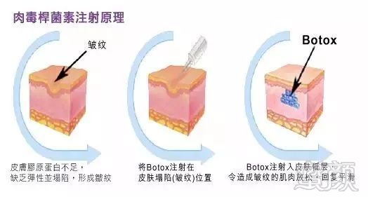 案例图片