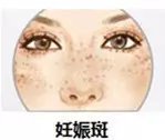 https://img.miyanlife.com/mnt/timg/180119/1154463130-7.jpg