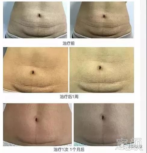 https://img.miyanlife.com/mnt/timg/180119/120R61145-10.jpg
