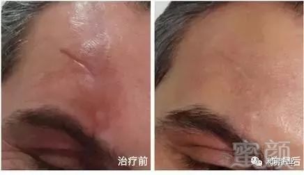 https://img.miyanlife.com/mnt/timg/180119/120R63504-8.jpg