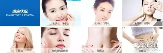 https://img.miyanlife.com/mnt/timg/180119/120RI411-18.jpg