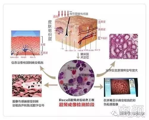 案例图片