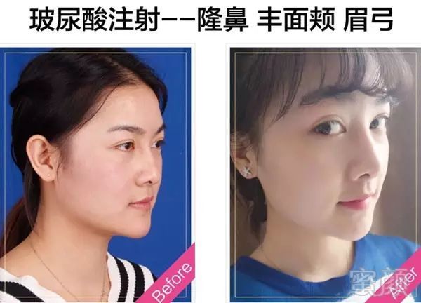 https://img.miyanlife.com/mnt/timg/180120/124KBJ6-0.jpg