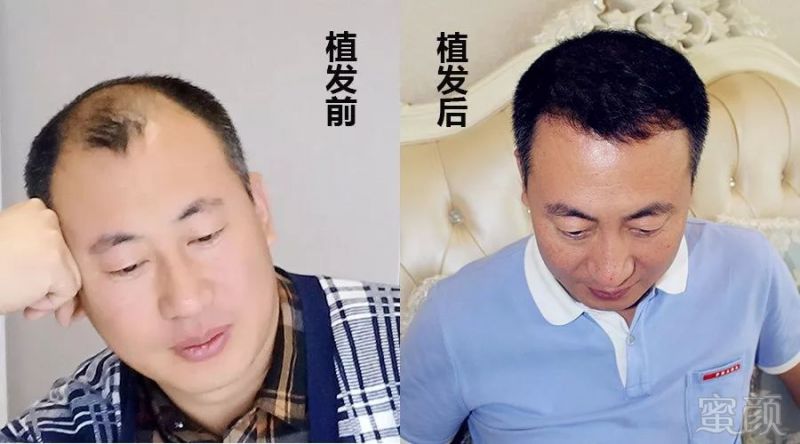 https://img.miyanlife.com/mnt/timg/180120/142015E31-3.jpg