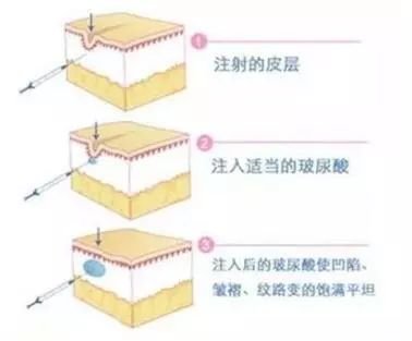 案例图片