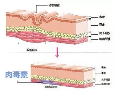 案例图片