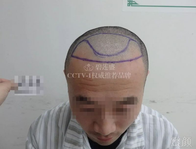 https://img.miyanlife.com/mnt/timg/180121/1231113618-4.jpg