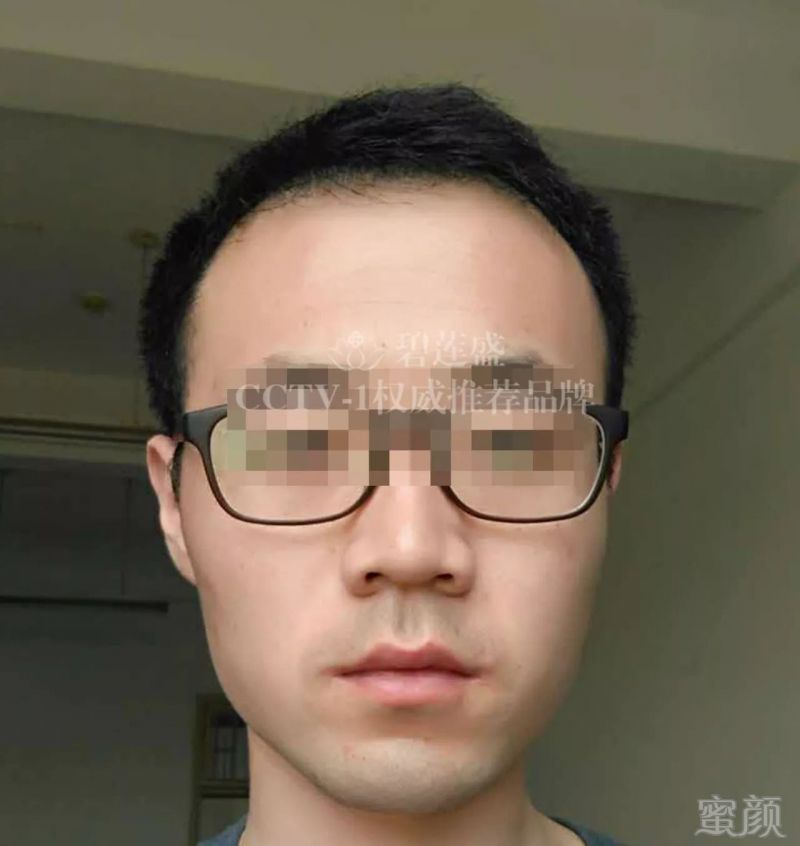 https://img.miyanlife.com/mnt/timg/180121/1231153100-8.jpg