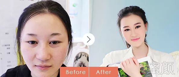 https://img.miyanlife.com/mnt/timg/180121/1232461295-1.jpg