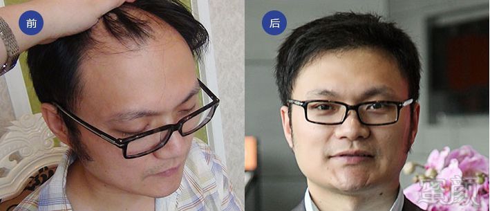 https://img.miyanlife.com/mnt/timg/180121/12324L512-2.jpg