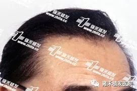 https://img.miyanlife.com/mnt/timg/180121/140IA2V-3.jpg