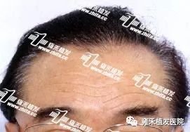 https://img.miyanlife.com/mnt/timg/180121/140IB305-2.jpg