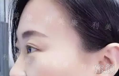 https://img.miyanlife.com/mnt/timg/180121/1410094533-2.jpg