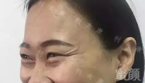 https://img.miyanlife.com/mnt/timg/180121/14100a007-1.jpg