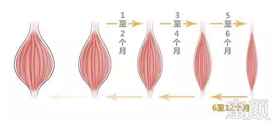 https://img.miyanlife.com/mnt/timg/180121/1410112618-8.jpg
