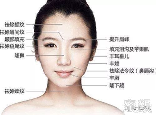 https://img.miyanlife.com/mnt/timg/180122/105KB192-3.jpg