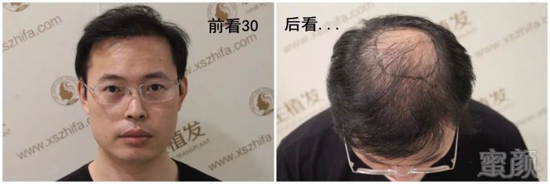 https://img.miyanlife.com/mnt/timg/180122/1150263354-2.jpg