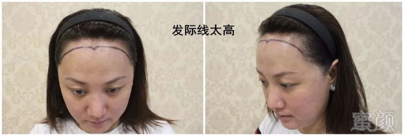 https://img.miyanlife.com/mnt/timg/180122/11502G4T-3.jpg