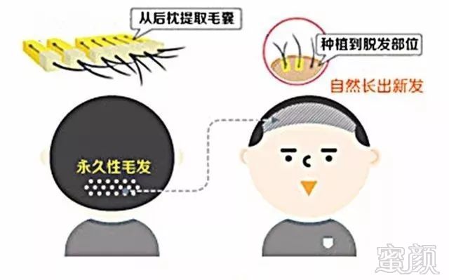 https://img.miyanlife.com/mnt/timg/180122/120GS262-1.jpg