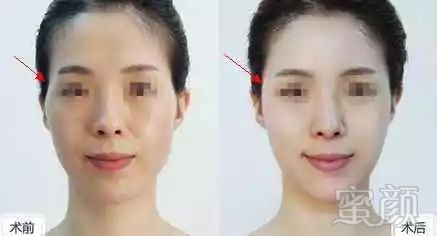 https://img.miyanlife.com/mnt/timg/180123/110RG094-8.jpg