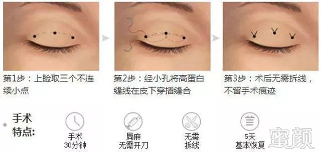 https://img.miyanlife.com/mnt/timg/180123/11324UY8-10.jpg