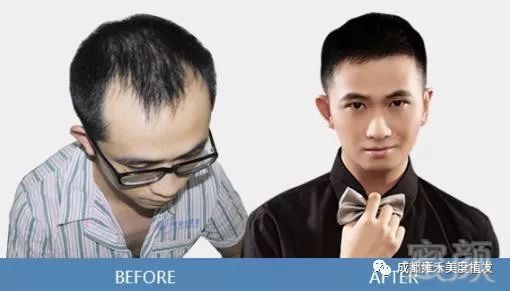 https://img.miyanlife.com/mnt/timg/180123/123J11958-3.jpg