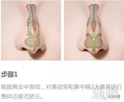 https://img.miyanlife.com/mnt/timg/180123/1251164U1-1.jpg