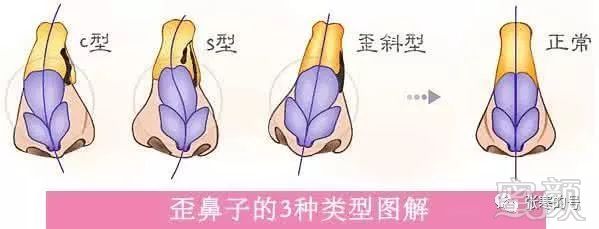 https://img.miyanlife.com/mnt/timg/180123/12511B208-0.jpg