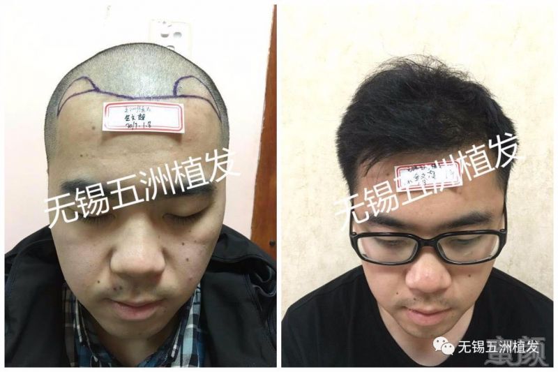 https://img.miyanlife.com/mnt/timg/180123/13135S148-1.jpg