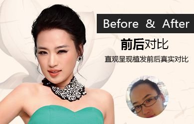 https://img.miyanlife.com/mnt/timg/180123/13150A931-0.jpg