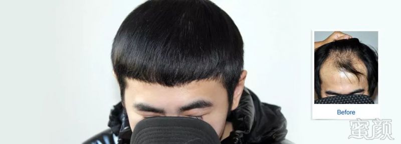 https://img.miyanlife.com/mnt/timg/180123/13150G962-4.jpg