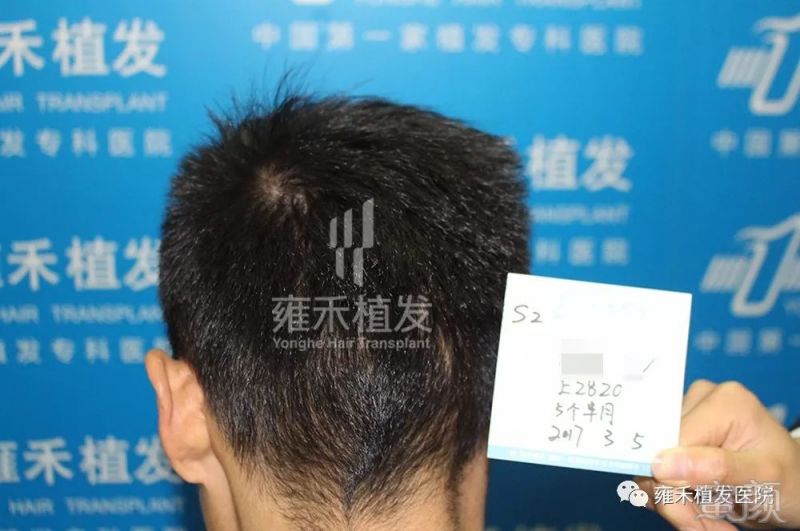 https://img.miyanlife.com/mnt/timg/180123/132402B21-5.jpg