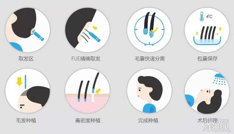 https://img.miyanlife.com/mnt/timg/180123/13314HD3-11.jpg