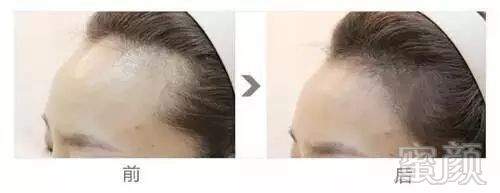 https://img.miyanlife.com/mnt/timg/180123/13314V038-15.jpg
