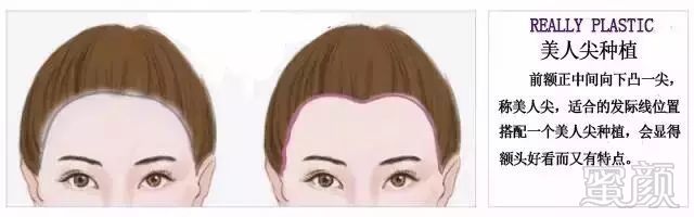 https://img.miyanlife.com/mnt/timg/180123/13314VC9-13.jpg