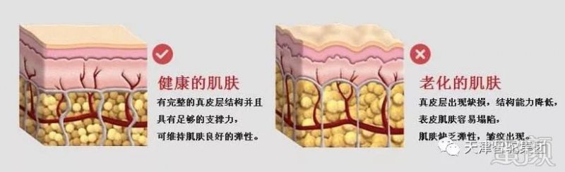 案例图片